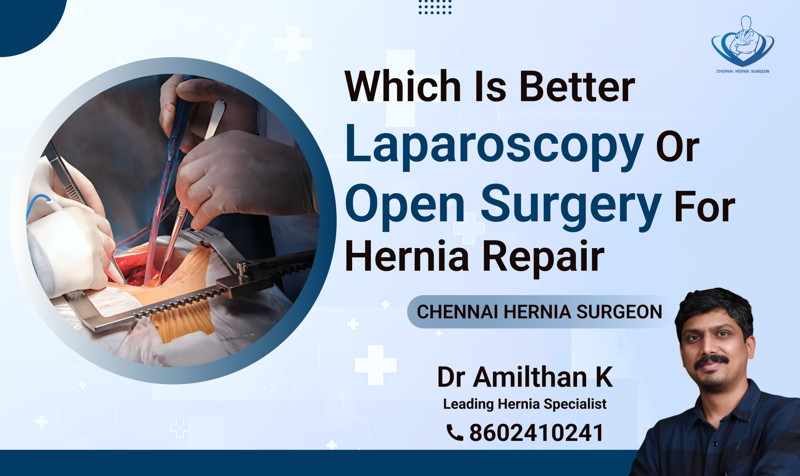 Which is better Laparoscopy or Open surgery for Hernia Repair